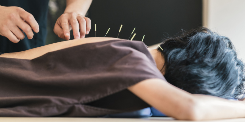 médecine douce acupuncture